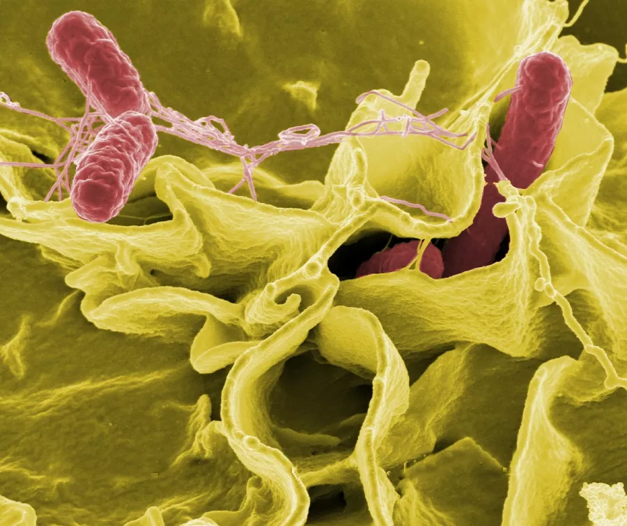 夏季警惕这种食源性疾病，田根全主任解读：沙门氏菌到底有多可怕？